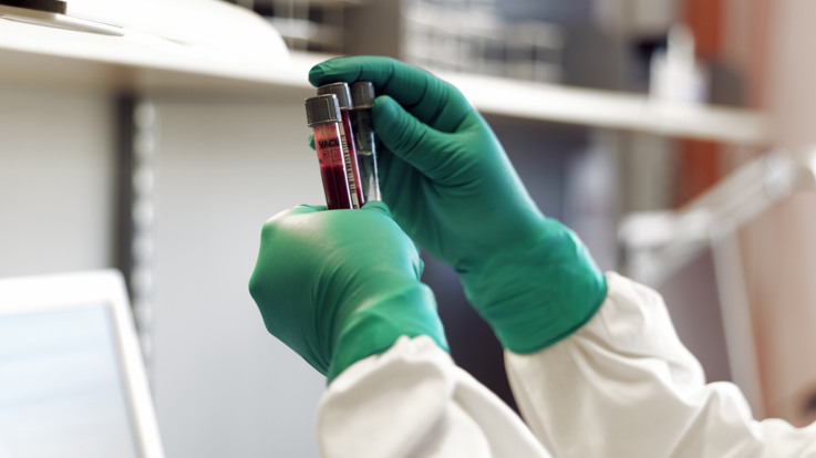 En person i labbrock som håller i en flaska.