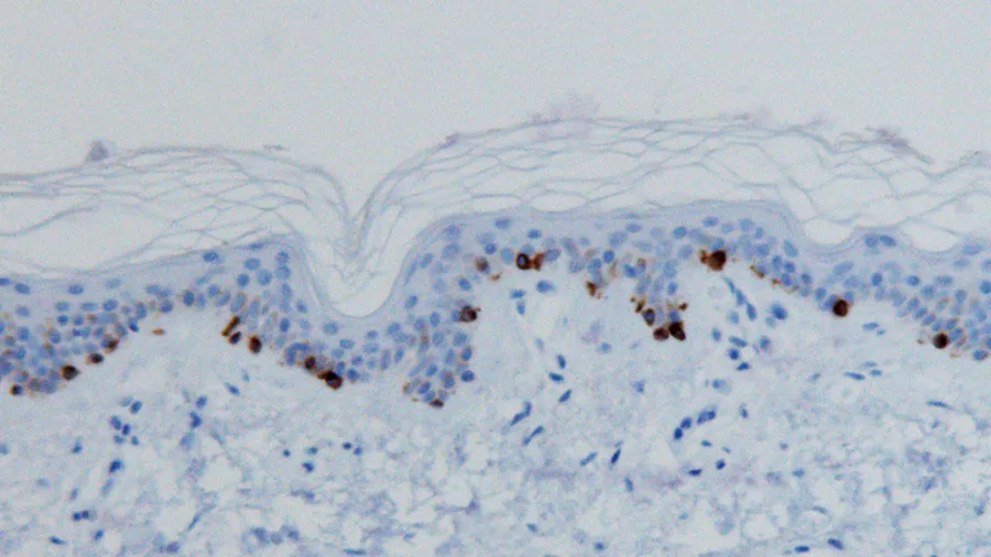 Bild på hud i genomskärning.